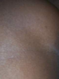 Black Mature Black Dots